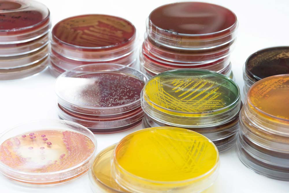 Аргозные гели