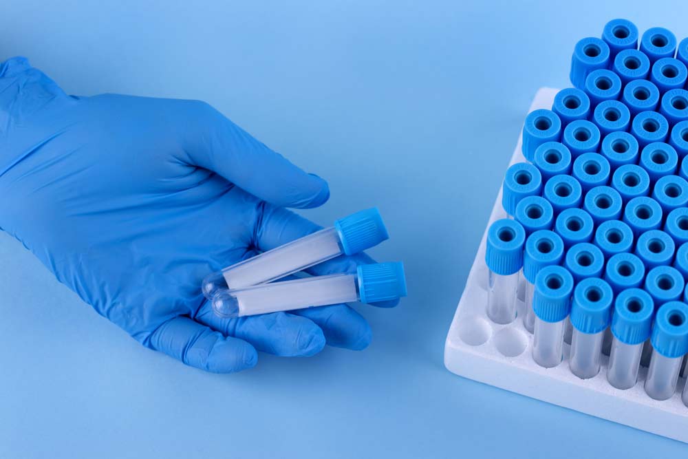 Пробирки для клеточных культур