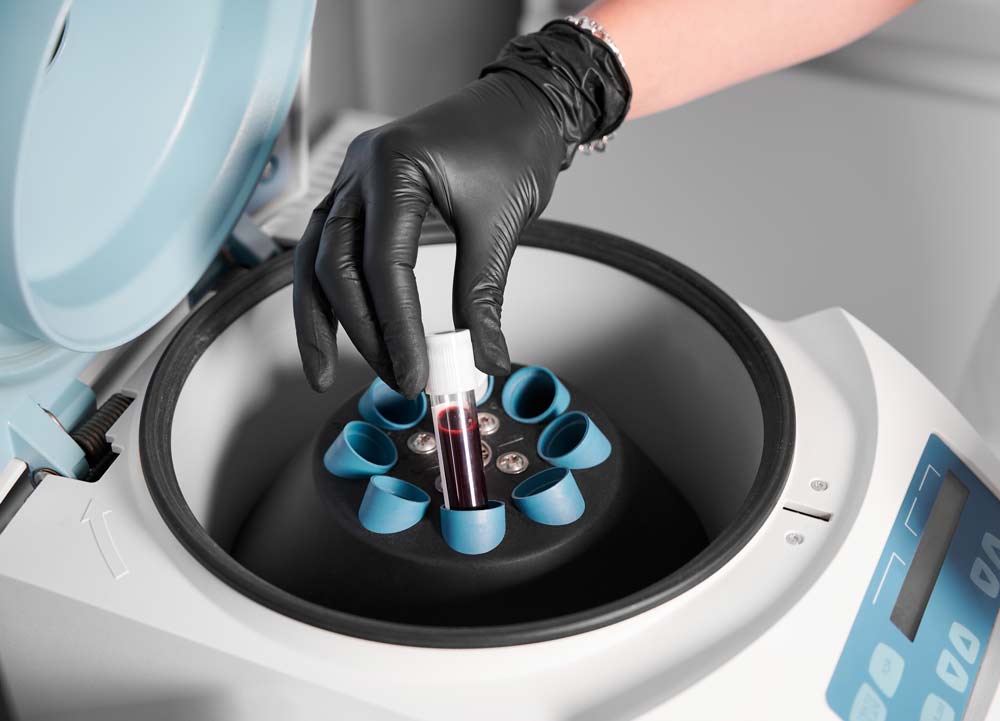 Центрифугирование